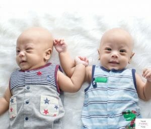 Newborn twins lying on their back. This article discusses how to get sleep with newborn twins.